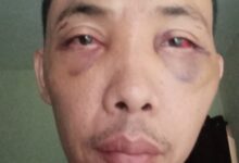 Wartawan di kroyok sama anak lurah, diduga preman. Gara gara burung dara terbang dari kandangnya.