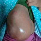 Nurlela (32)Warga Kp, Balungbang RT/RW 07/02 Desa Sanding Kecamatan Petir Kabupaten Serang