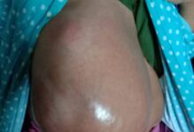 Nurlela (32)Warga Kp, Balungbang RT/RW 07/02 Desa Sanding Kecamatan Petir Kabupaten Serang