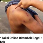 Ditembak Begal 10 Kali dan dikroyok 4 orang di Lebak sopir taksi onlaen selamat.