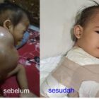Apalagi hendak dikata, dan tidak semua orang mendapatkan keturunan yang sempurna
