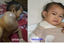 Apalagi hendak dikata, dan tidak semua orang mendapatkan keturunan yang sempurna