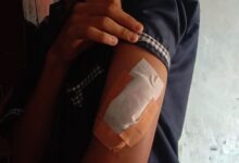 Kejadian itu tepatnya di depan SMAN 11 Sepatan, waktu itu saya mau beli nasi kuning, di celurit