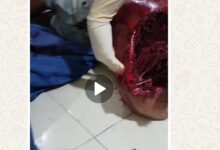 Remaja itu tidak berdaya, sehingga leher dan badan sempat misah di temukan oleh warga.