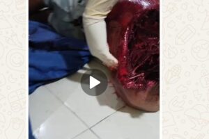 Remaja itu tidak berdaya, sehingga leher dan badan sempat misah di temukan oleh warga.
